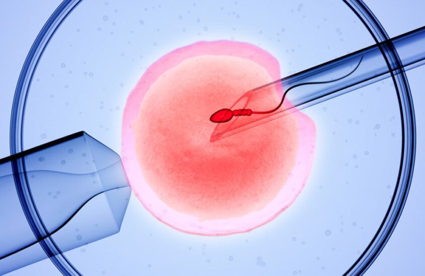 IVF